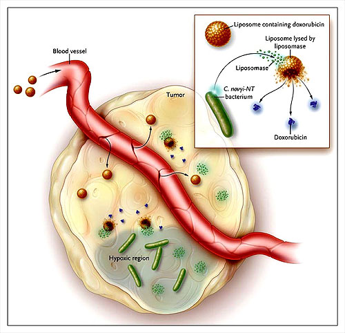 Figura 1: dirigiendo drogas hacia el tumor mediante bacterias.