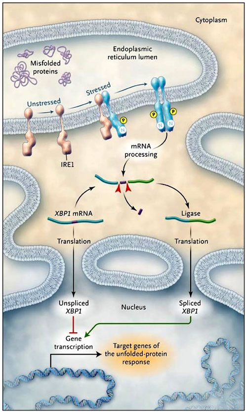 Figura 1: estrés celular y enfermedad inflamatoria intestinal