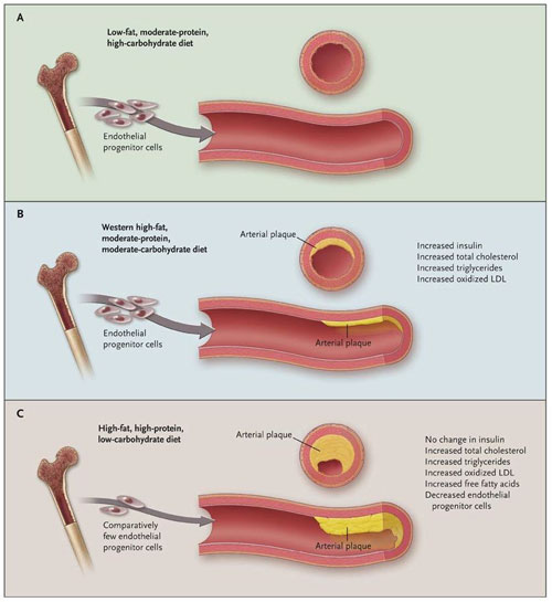 Figura 1: dieta alta en proteínas y baja en carbohidratos (HPLC) y la aterosclerosis