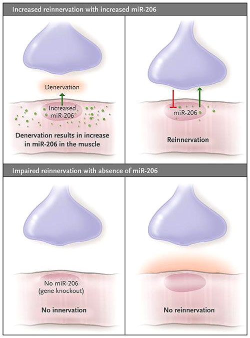 Figura 1: miARN en los músculos de la esclerosis lateral amiotrófica