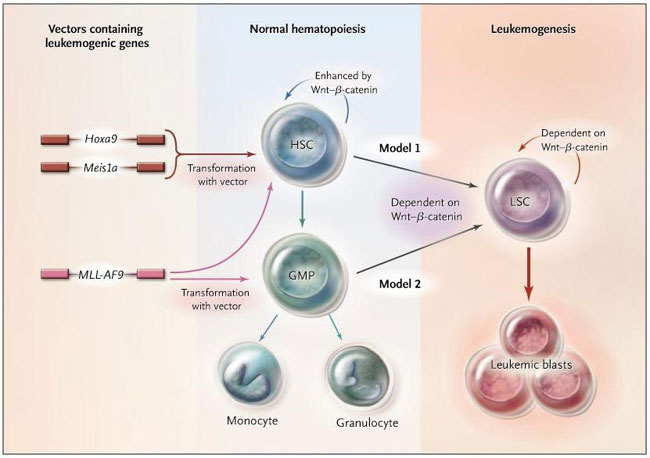 Figura 1: señalización de Wnt y dos modelos de leucemia
